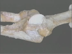 elbow skeleton